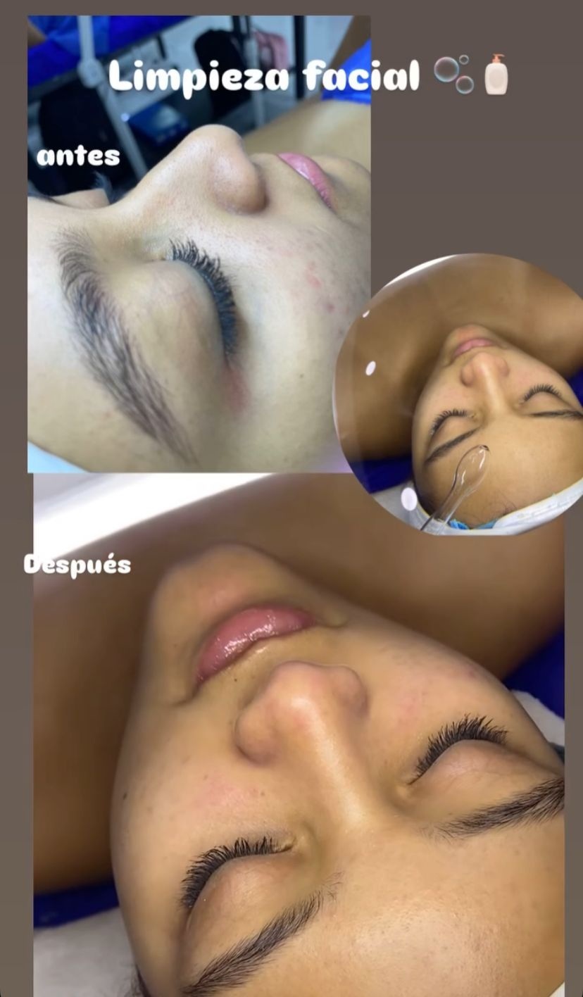 Limpieza facial